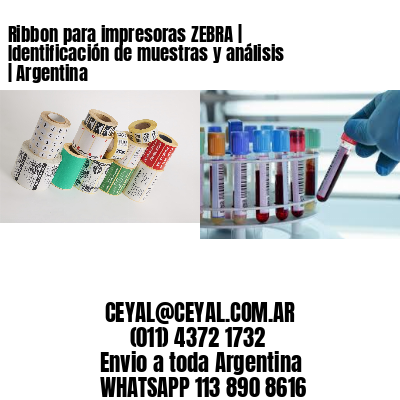 Ribbon para impresoras ZEBRA | Identificación de muestras y análisis | Argentina